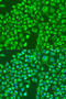 Discs Large MAGUK Scaffold Protein 4 antibody, STJ27954, St John