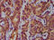 Aminoadipate-Semialdehyde Synthase antibody, LS-C680108, Lifespan Biosciences, Immunohistochemistry paraffin image 