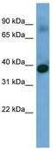 Sideroflexin 4 antibody, TA337637, Origene, Western Blot image 