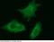 Complexin 2 antibody, 11927-R021, Sino Biological, Immunohistochemistry paraffin image 