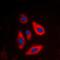 Follicle Stimulating Hormone Receptor antibody, orb213951, Biorbyt, Immunofluorescence image 