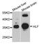 HLF Transcription Factor, PAR BZIP Family Member antibody, MBS126812, MyBioSource, Western Blot image 