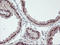 Regulatory Factor X Associated Ankyrin Containing Protein antibody, TA504273, Origene, Immunohistochemistry frozen image 