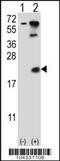 Ubiquitin-conjugating enzyme E2 B antibody, 61-079, ProSci, Western Blot image 