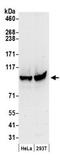 Minichromosome Maintenance Complex Component 3 antibody, GTX24460, GeneTex, Western Blot image 