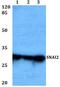 Zinc finger protein SNAI2 antibody, A01615-1, Boster Biological Technology, Western Blot image 