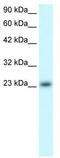 MAX Dimerization Protein 4 antibody, TA331159, Origene, Western Blot image 
