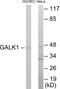 Galactokinase 1 antibody, EKC1735, Boster Biological Technology, Western Blot image 