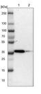 Melatonin Receptor 1B antibody, NBP1-84984, Novus Biologicals, Western Blot image 