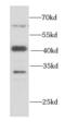 SWI/SNF-related matrix-associated actin-dependent regulator of chromatin subfamily B member 1 antibody, FNab08008, FineTest, Western Blot image 