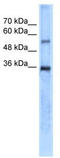 Carbonic Anhydrase 8 antibody, TA346371, Origene, Western Blot image 