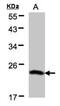 Basic Transcription Factor 3 antibody, NBP1-32292, Novus Biologicals, Western Blot image 
