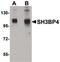 SH3 Domain Binding Protein 4 antibody, PA5-20747, Invitrogen Antibodies, Western Blot image 