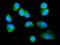 FMR1 Autosomal Homolog 1 antibody, A03308-2, Boster Biological Technology, Immunofluorescence image 
