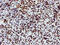 Non-POU Domain Containing Octamer Binding antibody, M03515-1, Boster Biological Technology, Immunohistochemistry paraffin image 