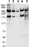 Chromodomain Helicase DNA Binding Protein 4 antibody, ab72418, Abcam, Western Blot image 