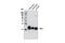 Thy-1 Cell Surface Antigen antibody, 9798S, Cell Signaling Technology, Western Blot image 