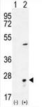 Visinin Like 1 antibody, AP54522PU-N, Origene, Western Blot image 