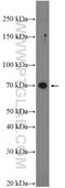 ADAM Metallopeptidase Domain 10 antibody, 25900-1-AP, Proteintech Group, Western Blot image 