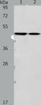 Glycine Receptor Alpha 1 antibody, TA321077, Origene, Western Blot image 