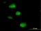 Sjoegren syndrome nuclear autoantigen 1 antibody, H00008636-B01P, Novus Biologicals, Immunocytochemistry image 