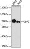 Guanylate Binding Protein 2 antibody, GTX66148, GeneTex, Western Blot image 