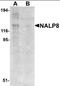 NLR Family Pyrin Domain Containing 8 antibody, orb95134, Biorbyt, Western Blot image 