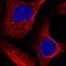 Stromal Interaction Molecule 2 antibody, HPA036933, Atlas Antibodies, Immunofluorescence image 