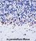 EPH Receptor A4 antibody, abx027686, Abbexa, Western Blot image 