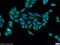 SLAIN Motif Family Member 1 antibody, 22123-1-AP, Proteintech Group, Immunofluorescence image 
