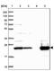 Isochorismatase Domain Containing 2 antibody, NBP1-82074, Novus Biologicals, Western Blot image 