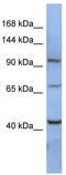RNA Binding Motif Protein 12 antibody, TA345943, Origene, Western Blot image 
