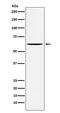 YES Proto-Oncogene 1, Src Family Tyrosine Kinase antibody, M02640-2, Boster Biological Technology, Western Blot image 