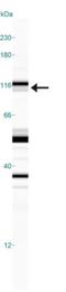 Solute Carrier Family 9 Member A3 antibody, NB110-81529, Novus Biologicals, Western Blot image 