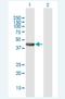N-acylglucosamine 2-epimerase antibody, H00005973-B01P-50ug, Novus Biologicals, Western Blot image 