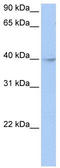 Zinc Finger And BTB Domain Containing 6 antibody, TA330127, Origene, Western Blot image 