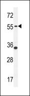 Phosphodiesterase 12 antibody, 55-121, ProSci, Western Blot image 
