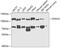 Probable ATP-dependent RNA helicase DDX20 antibody, GTX54029, GeneTex, Western Blot image 