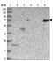 Coiled-Coil Domain Containing 30 antibody, NBP1-93963, Novus Biologicals, Western Blot image 