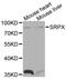 Sushi Repeat Containing Protein X-Linked antibody, MBS127185, MyBioSource, Western Blot image 