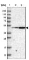 Platelet-activating factor acetylhydrolase IB subunit alpha antibody, NBP1-87769, Novus Biologicals, Western Blot image 