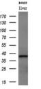 ZFP36 Ring Finger Protein antibody, M02028, Boster Biological Technology, Western Blot image 