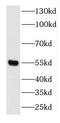 Docking protein 3 antibody, FNab02502, FineTest, Western Blot image 
