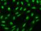 SATB Homeobox 2 antibody, 204067-T02, Sino Biological, Immunohistochemistry frozen image 
