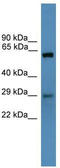 TP53 Regulating Kinase antibody, TA340214, Origene, Western Blot image 