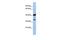 Leucine Rich Repeat Containing 57 antibody, GTX45250, GeneTex, Western Blot image 