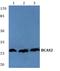 BCAS2 Pre-MRNA Processing Factor antibody, A07113-1, Boster Biological Technology, Western Blot image 