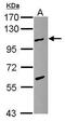 TPX2 Microtubule Nucleation Factor antibody, GTX115654, GeneTex, Western Blot image 