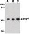 Golgi-associated PDZ and coiled-coil motif-containing protein antibody, LS-B1356, Lifespan Biosciences, Western Blot image 
