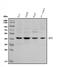 DNA Fragmentation Factor Subunit Alpha antibody, A03671-4, Boster Biological Technology, Western Blot image 